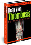 Your Guide to Deep Vein Thrombosis